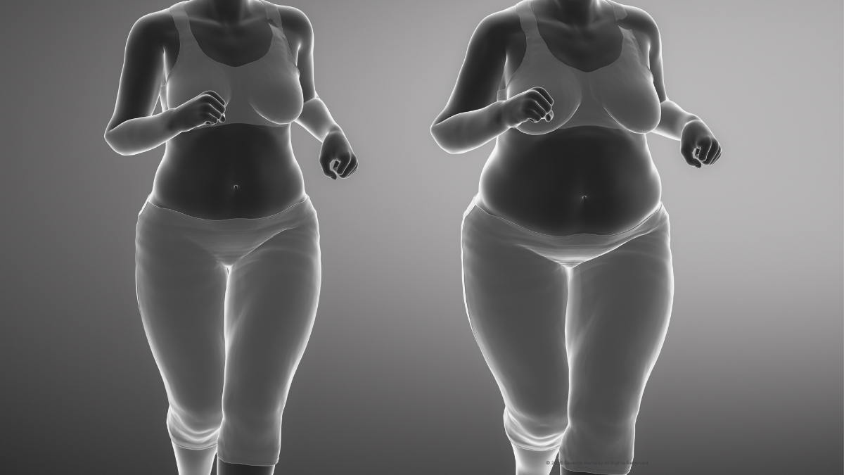 Illustration showing daily struggles of living with obesity