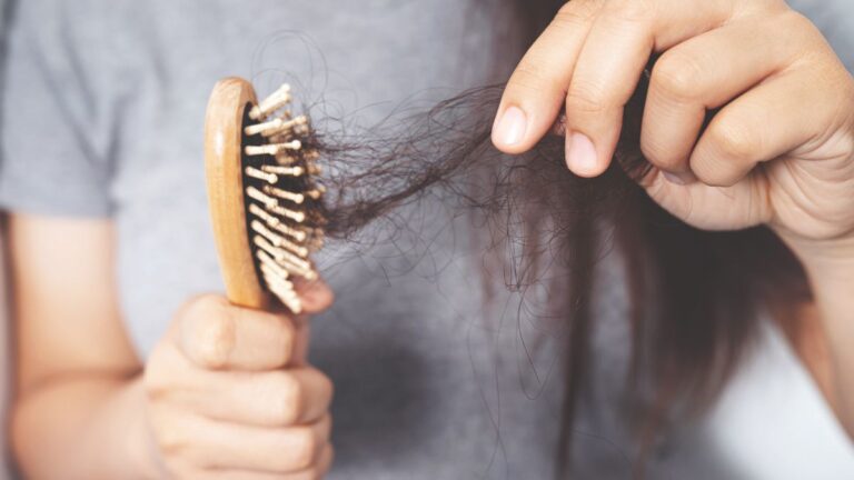 Woman with Hair loss due to weight loss